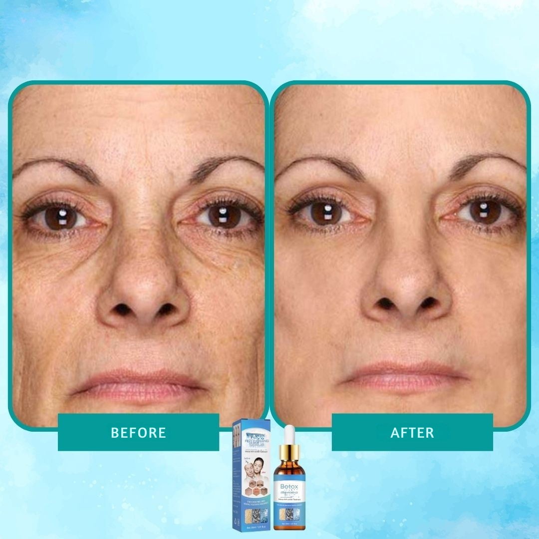 Intensywny eliksir przeciwzmarszczkowy z botoksem 